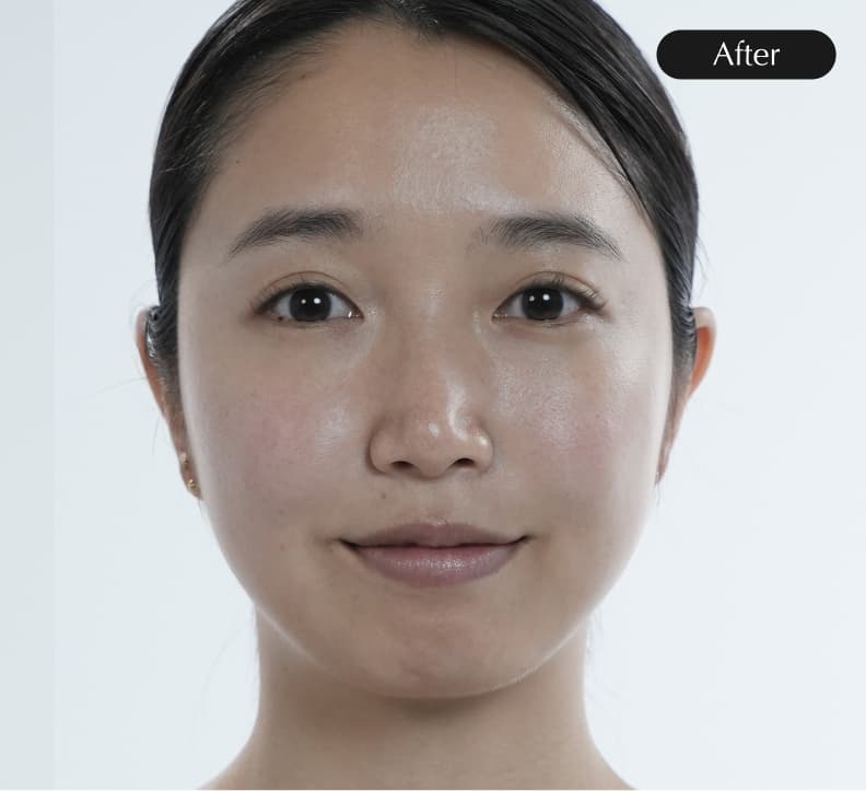 After