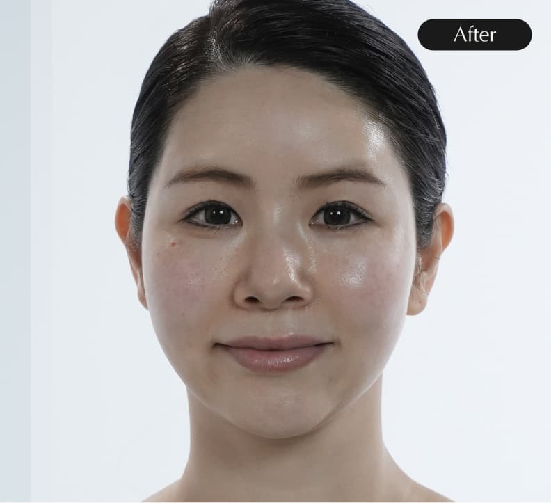 After