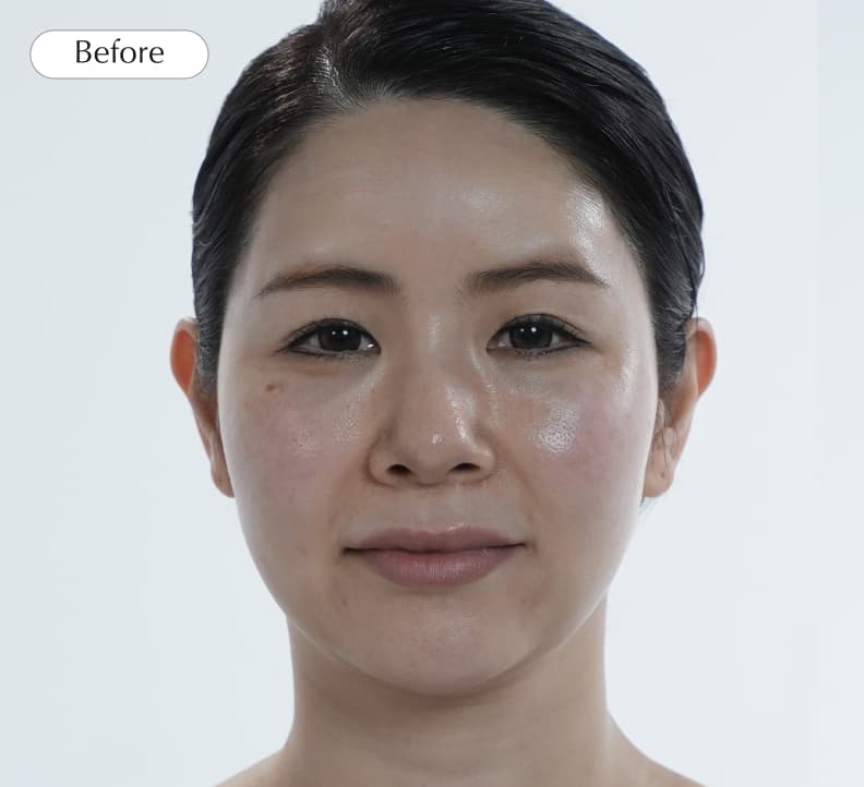 After